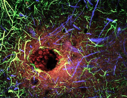 Image: Confocal light micrograph of a section through the brain showing a breakdown in the blood-brain barrier (Photo courtesy of C.J. Guerin, PhD, MRC Toxicology Unit / SPL).